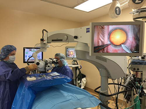 Performing Cataract Surgery