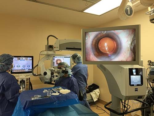 Doctors Performing Cataract Surgery